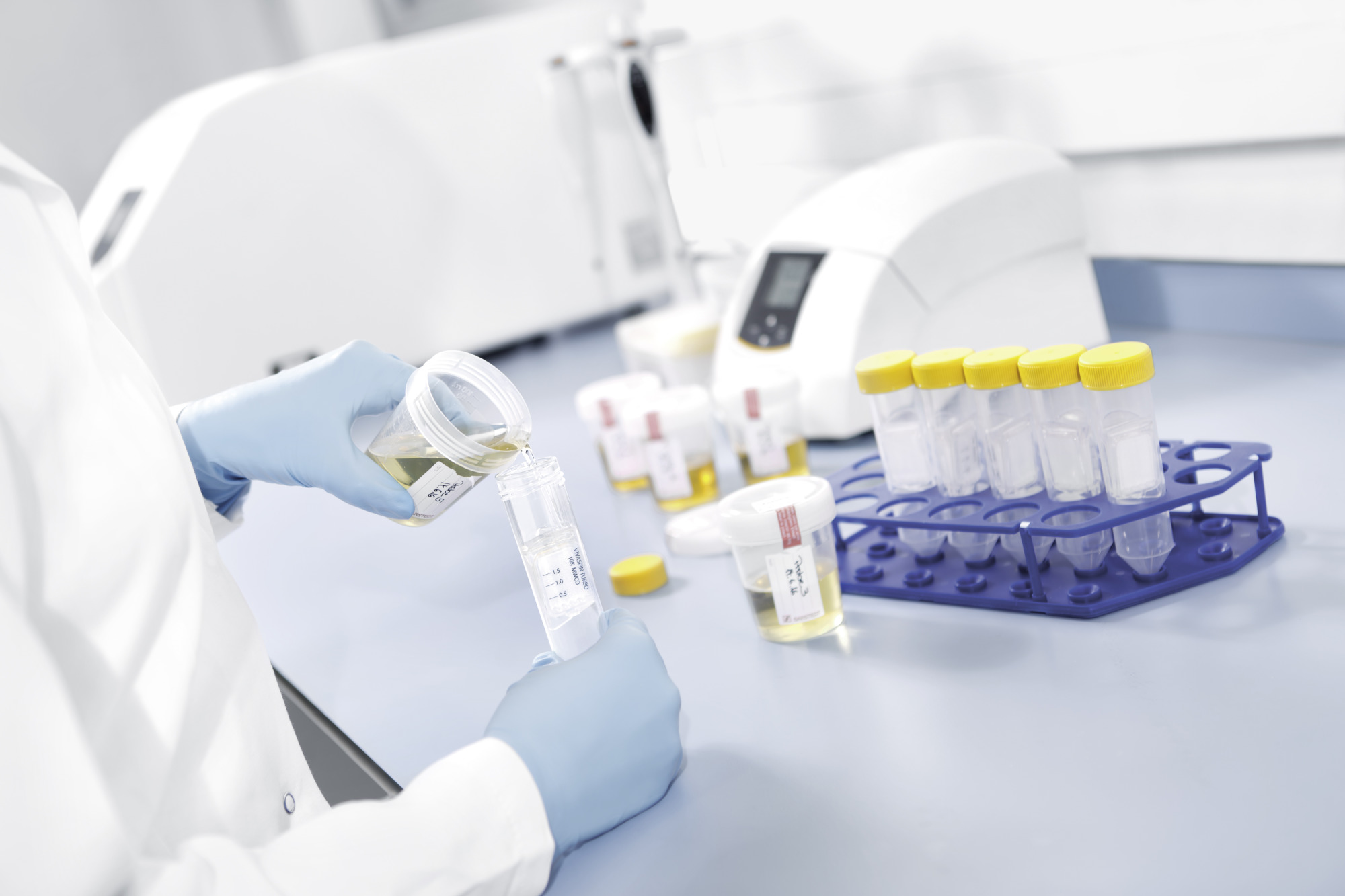 Centrifugalne jedinice - Sartorius Libra Elektronik
