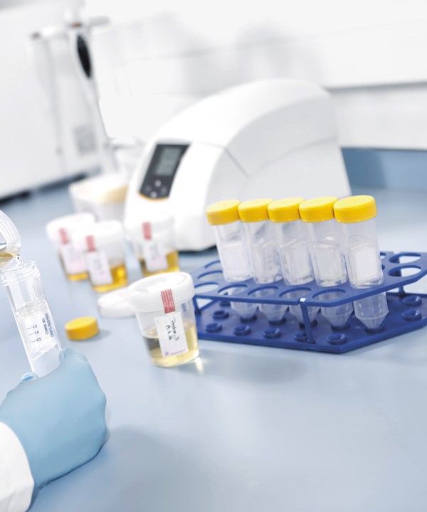Centrifugalne jedinice - Sartorius Libra Elektronik